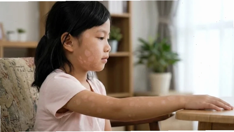 Điện thoại bị đốm đen đốm sáng thường liên quan đến rối loạn sắc tố màn hình