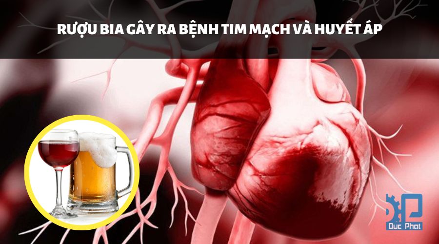 Rượu bia gây ra bệnh tim mạch và huyết áp